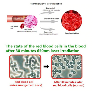 Blood Pressure Watch